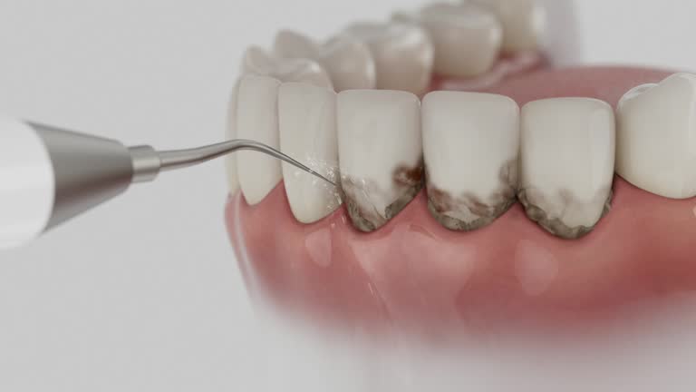 Reliable Dental Implants contractor in Valinda, CA by Smile Center Dentistry
